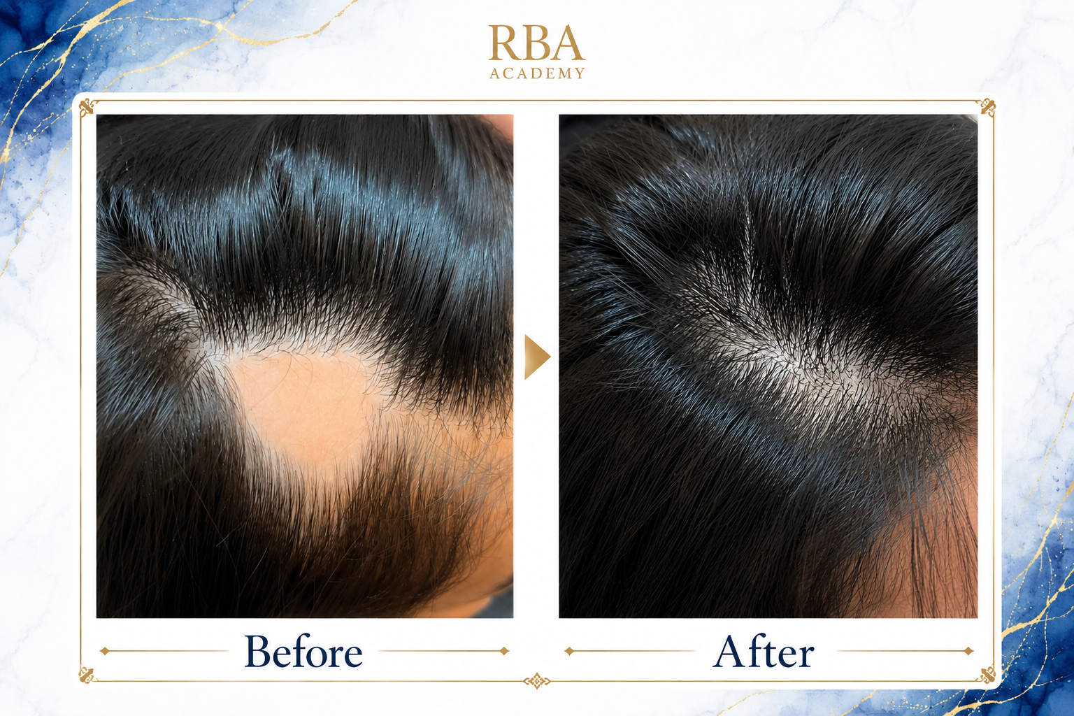 Before After