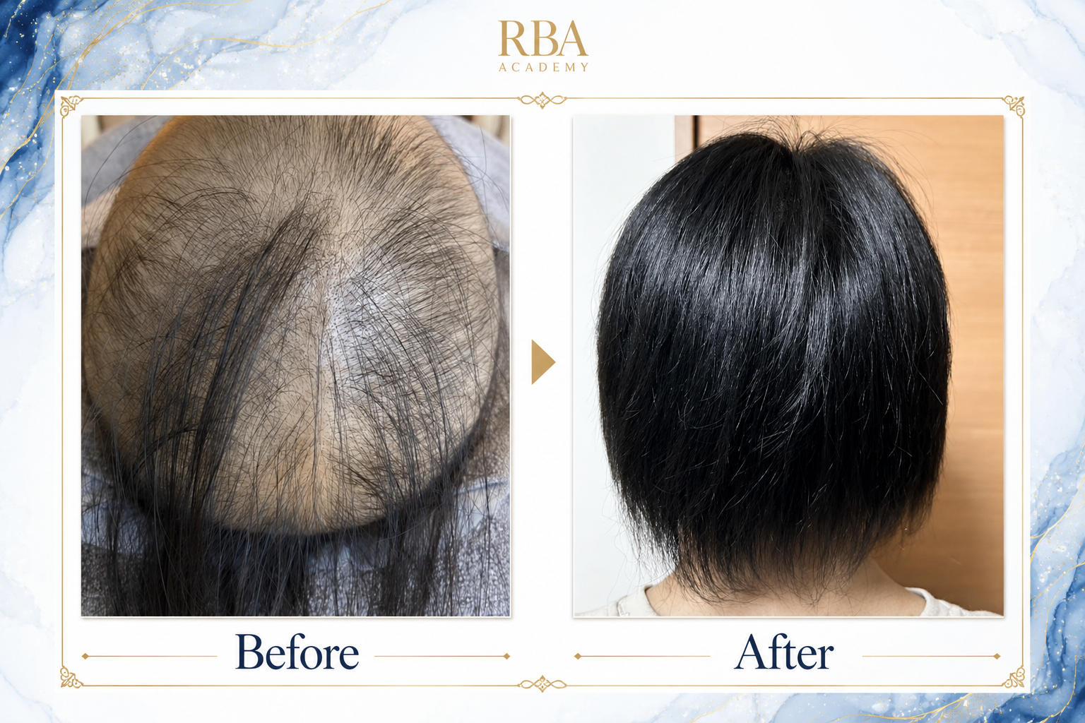 Before After