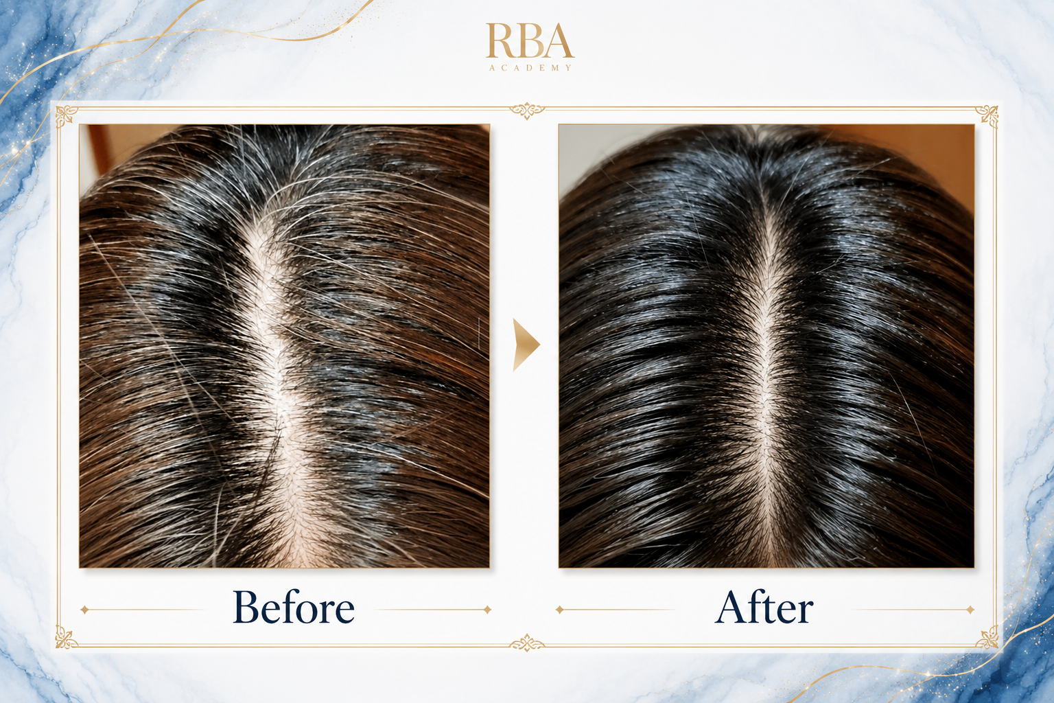 Before After