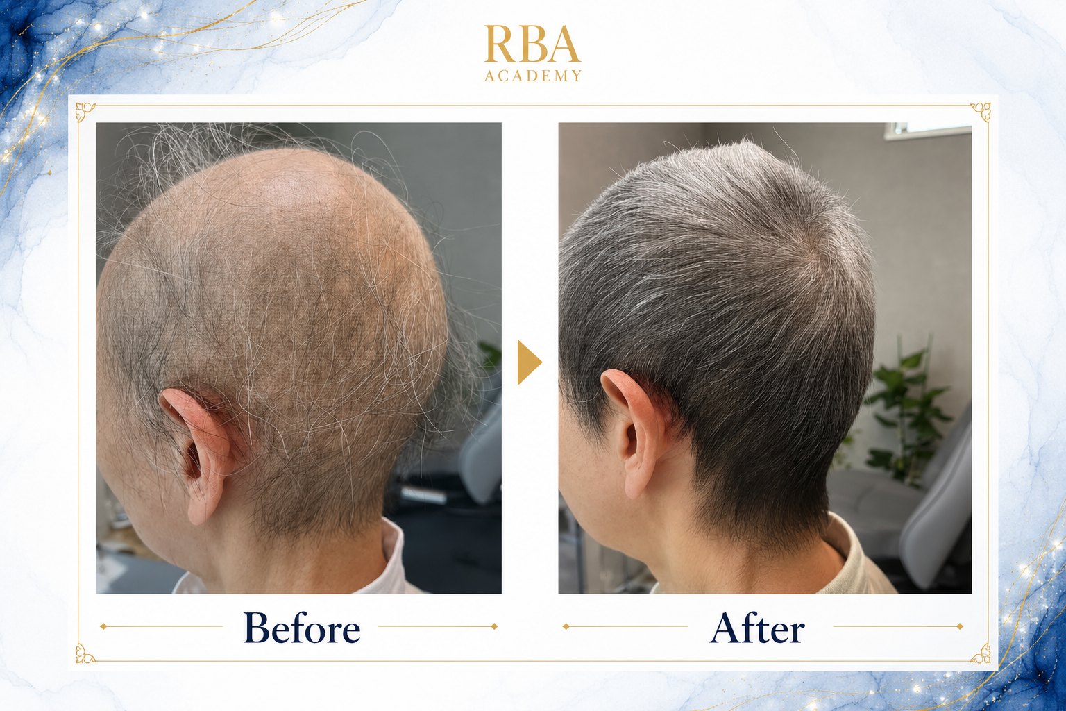 Before After