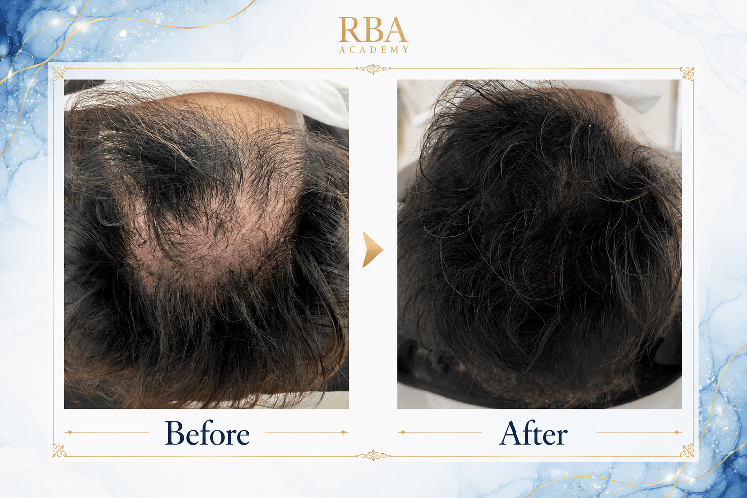 Before After