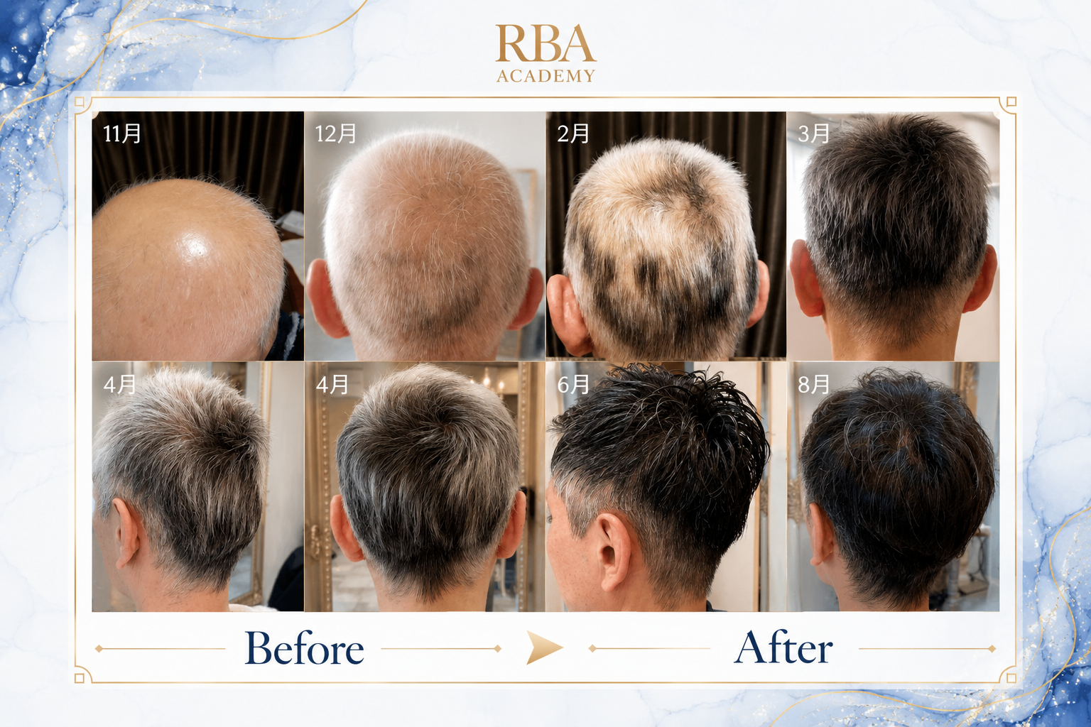 Before After